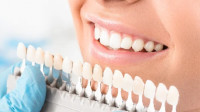 Teeth Whitening