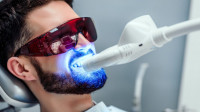 Tooth Whitening