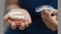 Invisalign