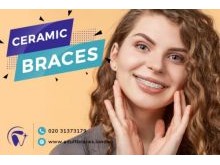 Ceramic braces